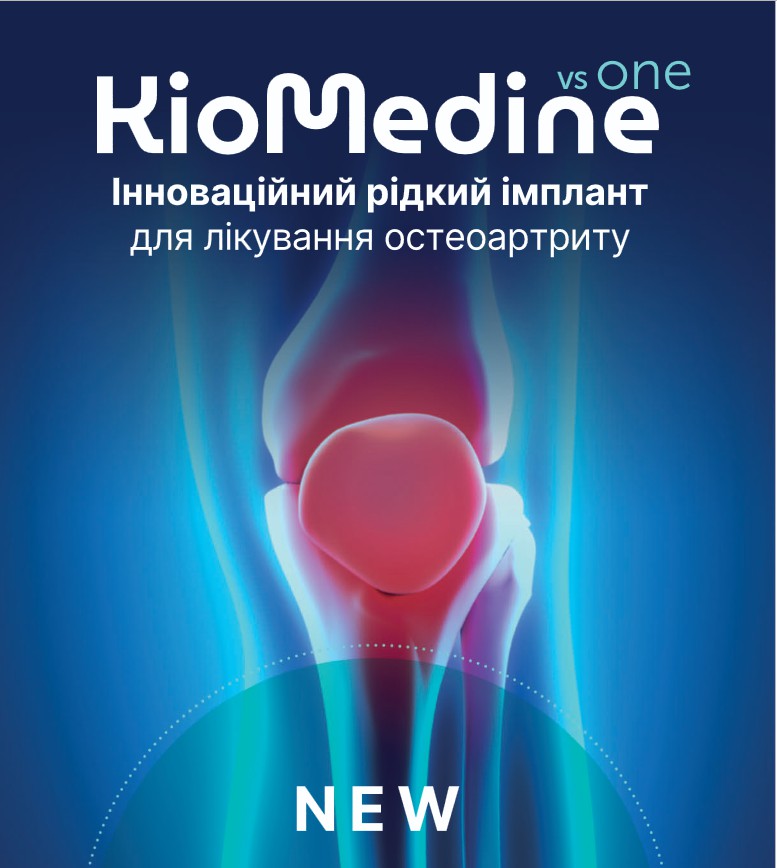 Остеоартрит коленного сустава: как помогает KioMedinevsone, когда другие методы не работают